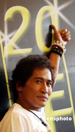 齐秦遭火纹身庆幸不愁吃喝称伤口如万只蚂蚁咬